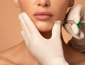 Kvinna som får fillers